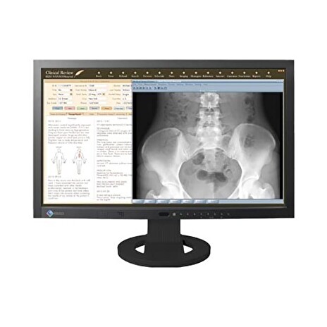 LCD EIZO 23" RadiForce MS230W; black
